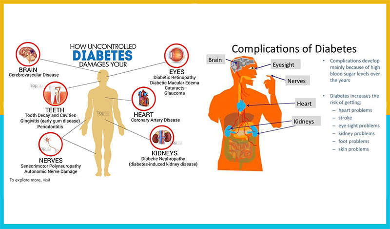 fiducial placement complications of diabetes